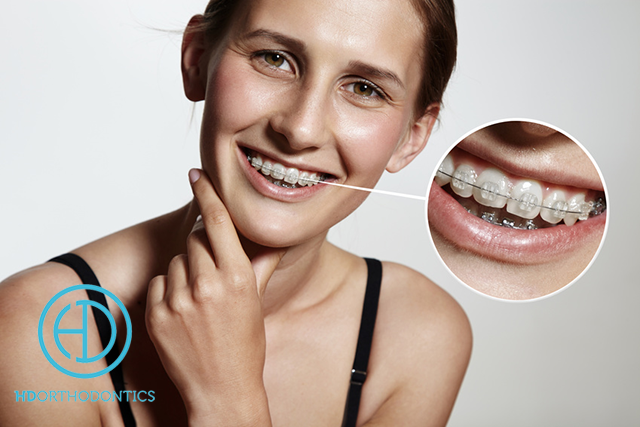 Orthodontic Treatment For Adults in Wilmington