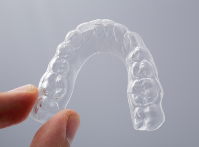 Clear Overlay Retainers