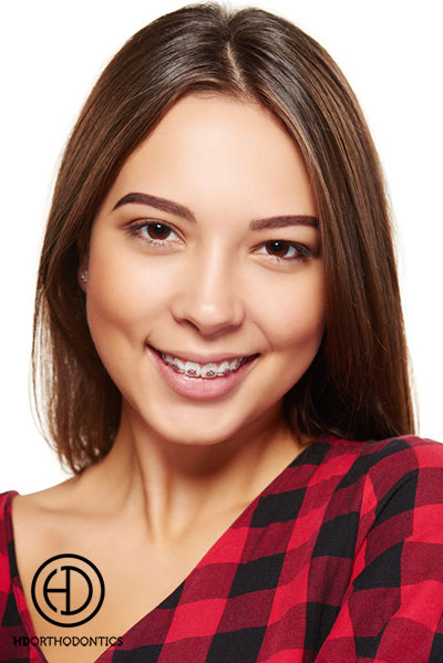 Why Do Adults Need Orthodontics?