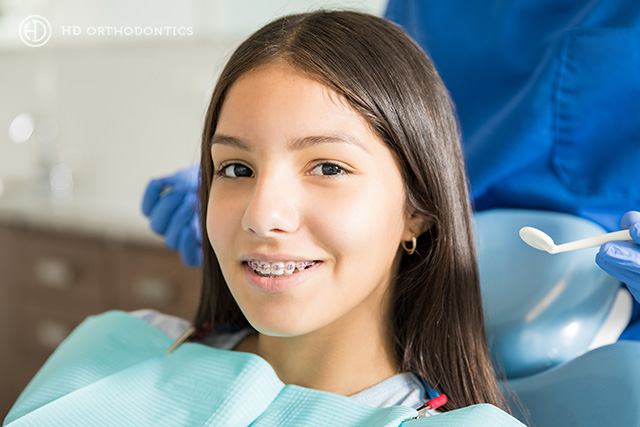 Orthodontic Treatment Times