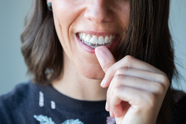 How Much is Invisalign Treatment Without Insurance?