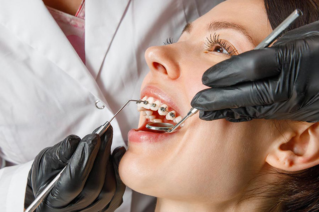 Does Insurance Cover Orthodontic Treatment?